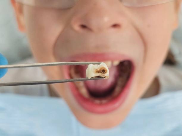 Best Emergency Treatment for Toothache in Clarence Center, NY
